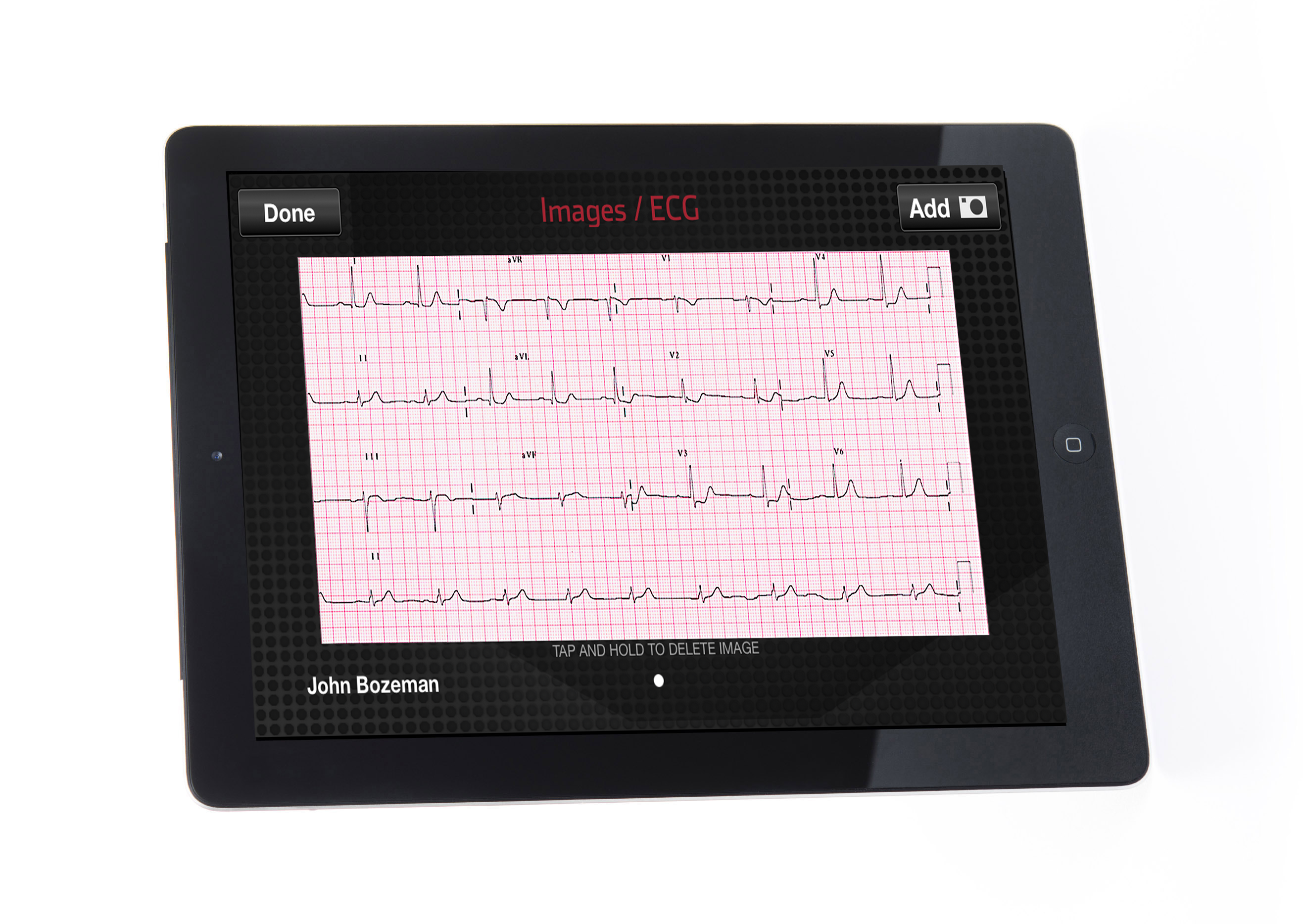 STEMI: 10 Things You Need to Know to Save Lives
