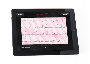 Stemi ECG Pulsara