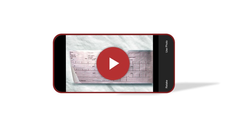 add-ecg-thumbnail