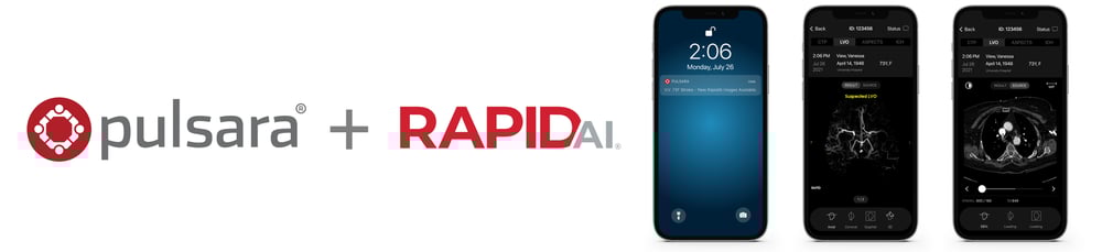 pulsara+rapid-ai-integration