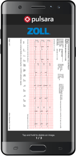 zoll-ecg-integration-device_@293x600
