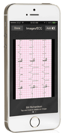 Pulsara-ECG.png