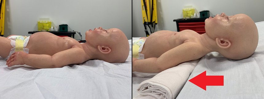 infant-mannequin-with-shoulder-roll-for-airway-mgmt-860x322