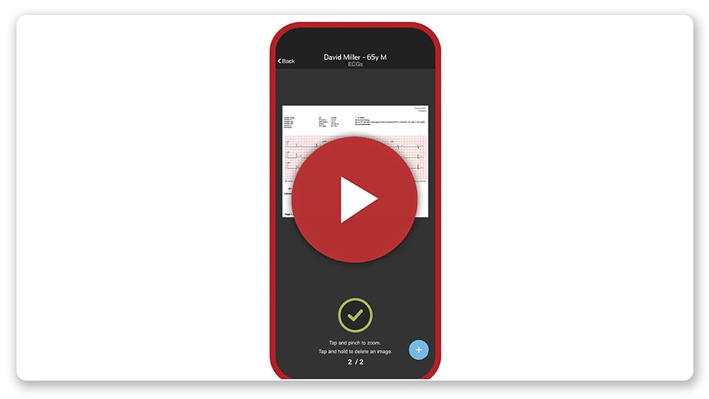 add-ecg-video-thumbnail@1000x563