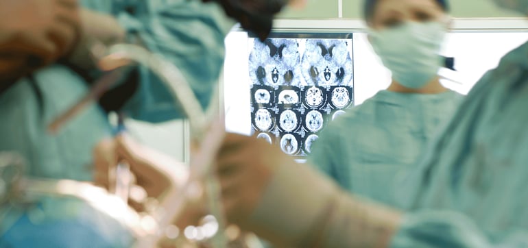 treating LVO stroke