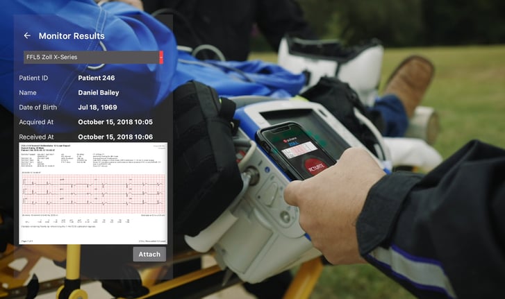 zoll-pulsara-ffl-stemi