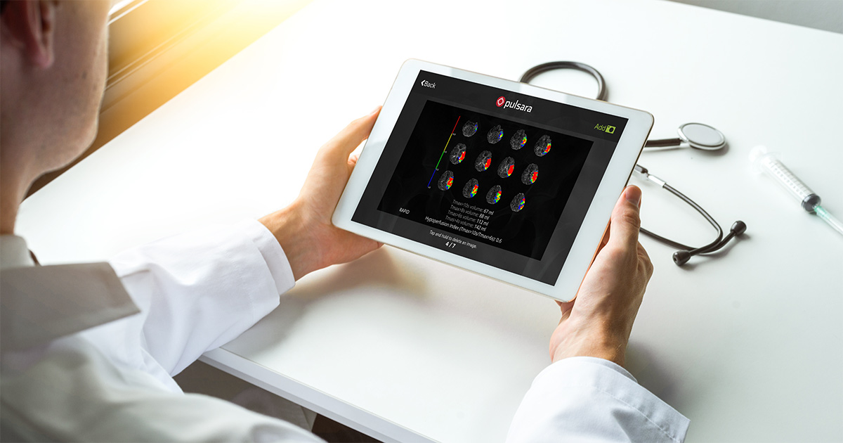 md-RAPID-scan-stroke-tablet
