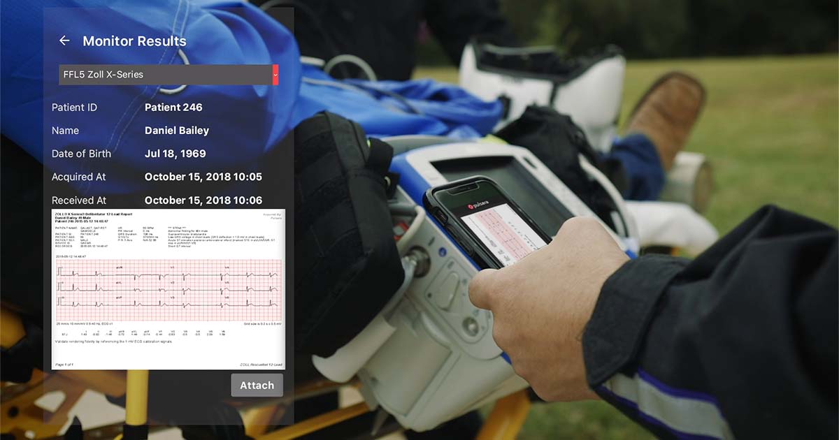 activate-team-zoll-pulsara-ffl-stemi-ecg