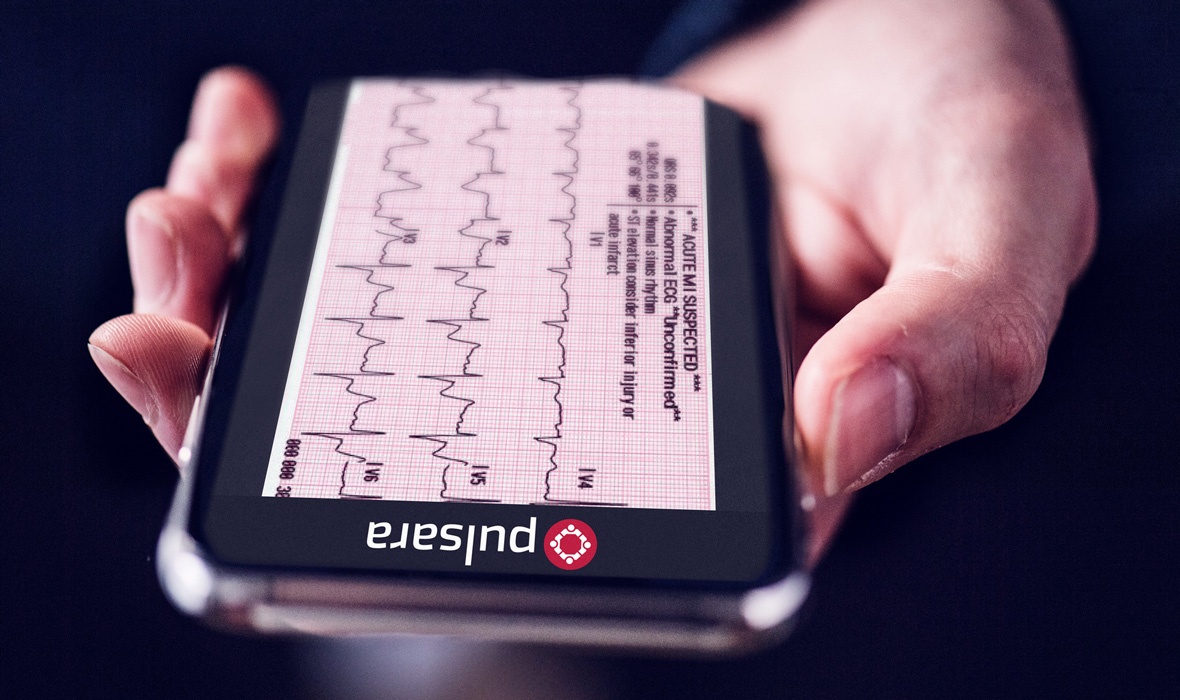 ecg-device-closeup