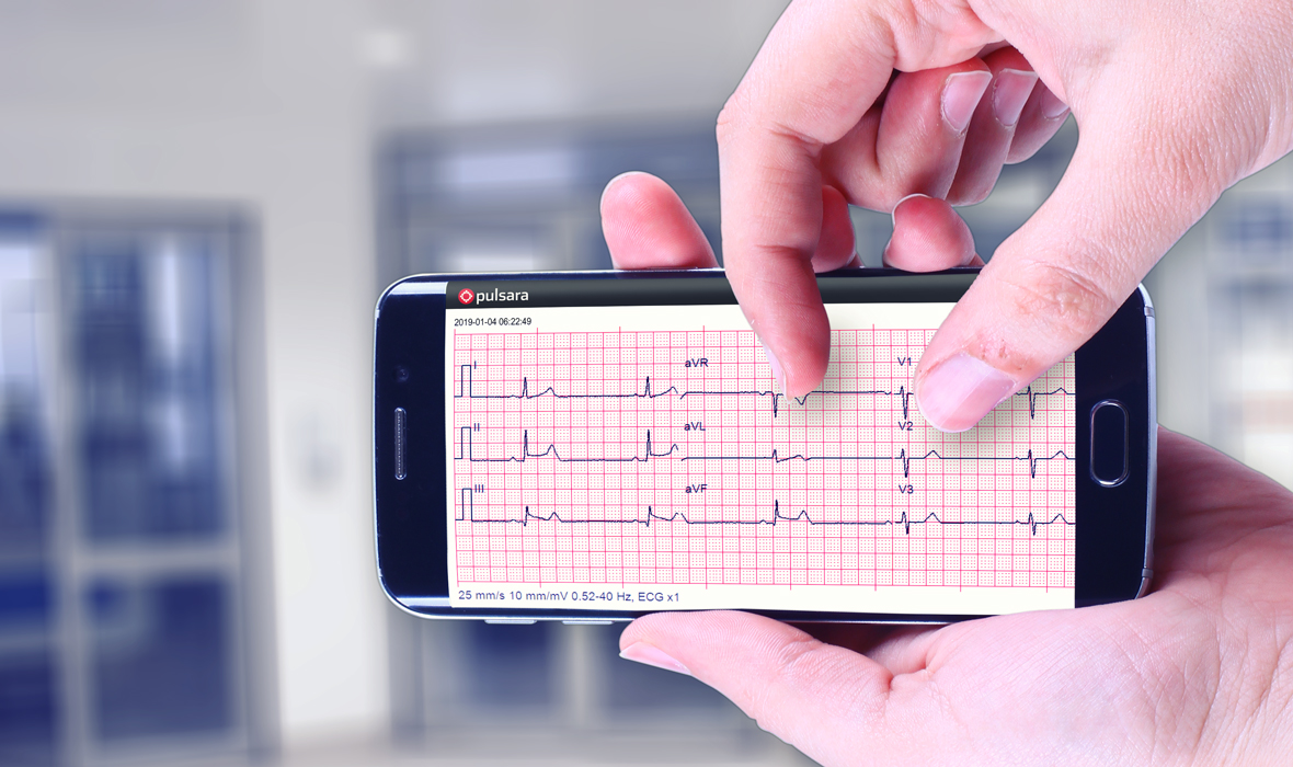 In-Hospital STEMIs Make Up 20% of all Cases -- But the Mortality Rate is 10x Higher for Those Patients